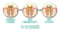 ҽԺҪǮ