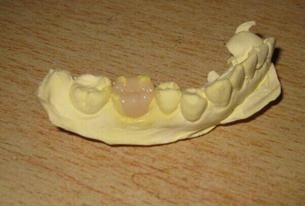 ͯȣݲģ