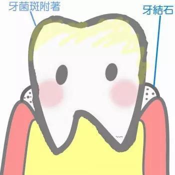 ʯ,ʯϴ,ʯΣ