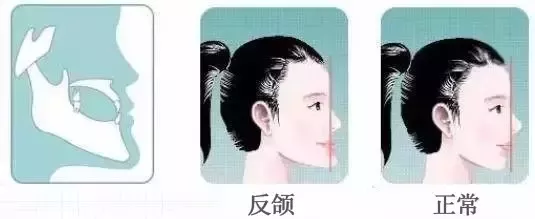 ӵذ죿ҳܺЩ⣡