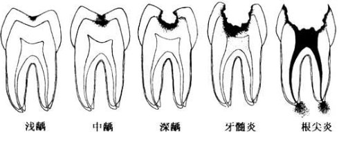 ȣݺô죿