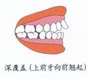  ֹһ֮