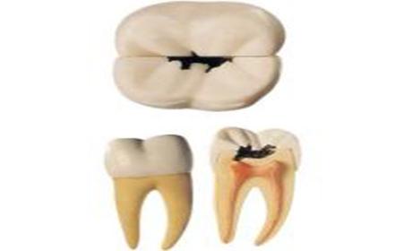 ô