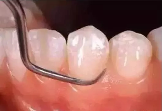 ά