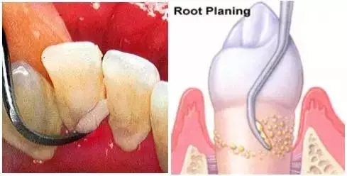 ׾csgo
ļҺã