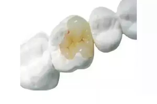Ƕ