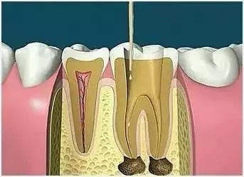 ϴ