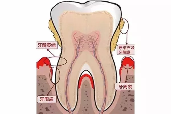 ϴ