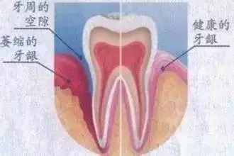 ή