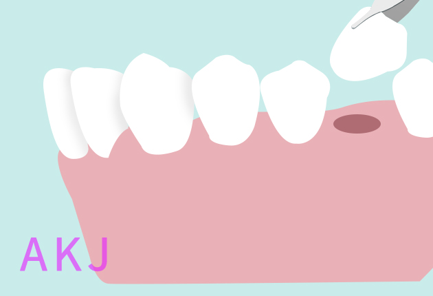 ݰγ