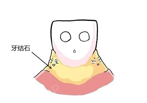 ʯ